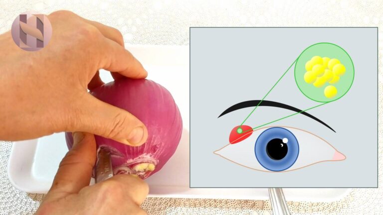 وصفة طبيعية لعلاج شعيرة العين